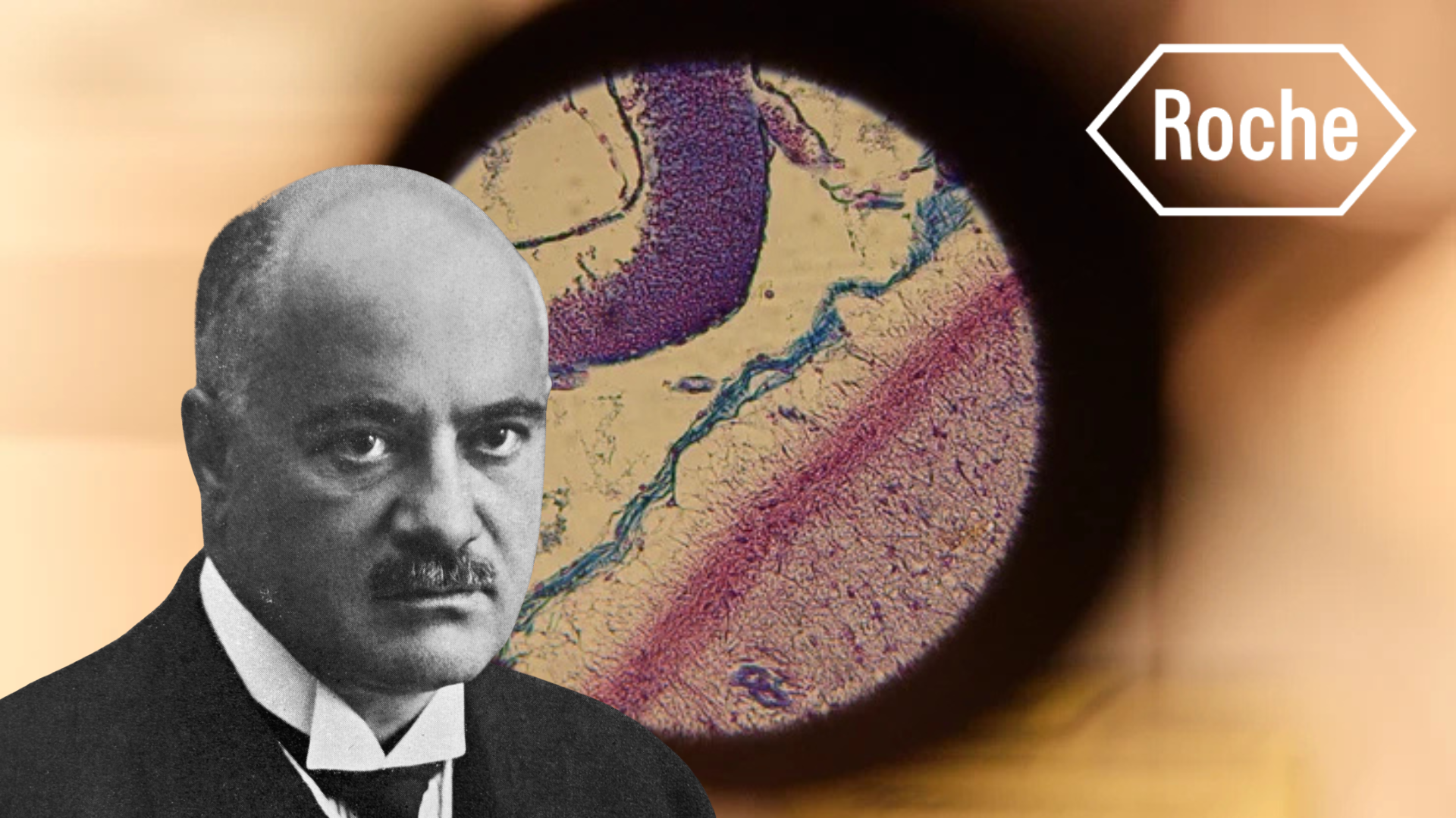 Roche